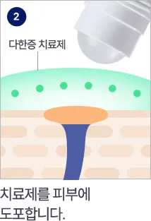 point03 배경